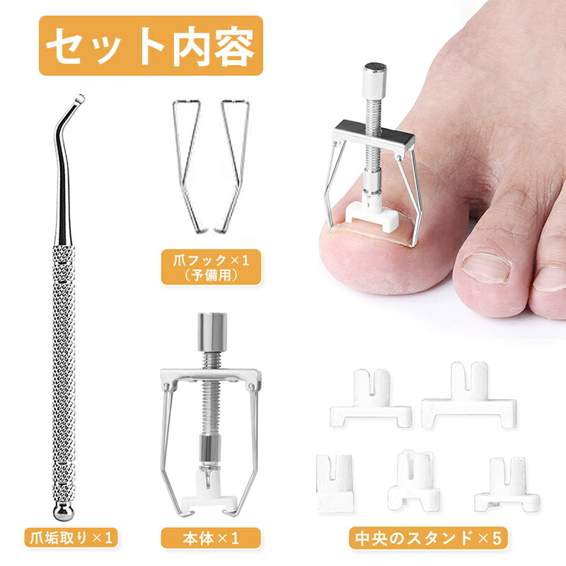 楽天市場】巻き爪 矯正 セット サポート 器具 【20分だけ改善