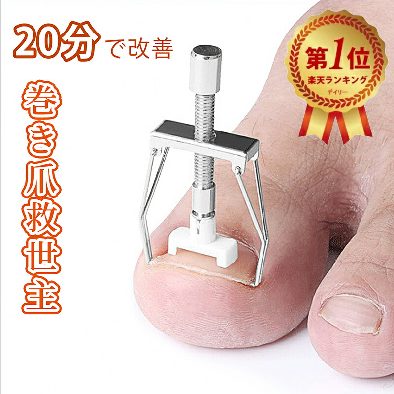 楽天市場】巻き爪 矯正 セット サポート 器具 【20分だけ改善
