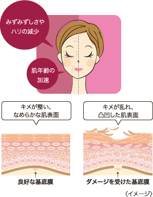 アプローチ X、アップビー発売 | きれいのレシピ by セプテムプロダクツ