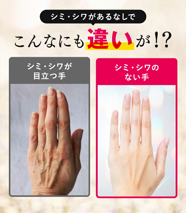 楽天市場】【話題のハンド美容液】薬用 ホワイト ハンドセラム 美容液