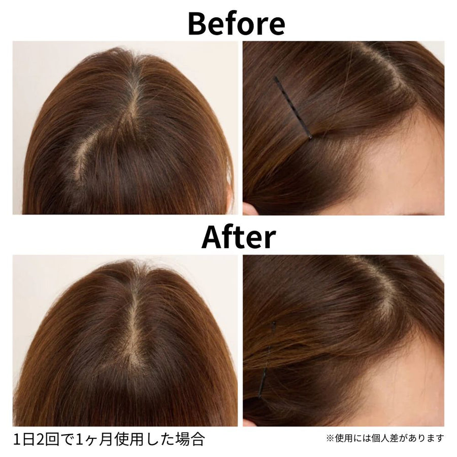 ヘア エッセンス - スカルプ エッセンス ROOT BEAUTÉ 育毛 エッセンス